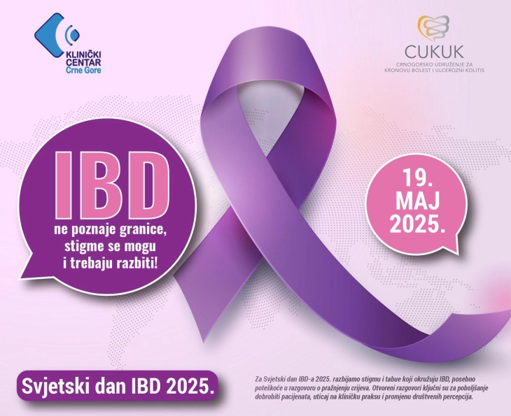U ponedjeljak predavanja povodom Svjetskog dana borbe protiv IBD-a